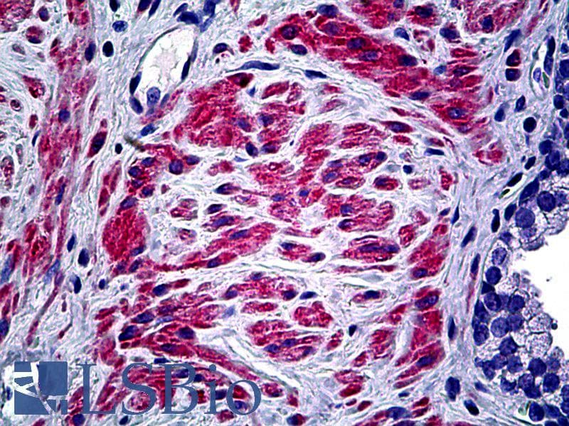 IHC-plus™ COL5A2 / Collagen V Alpha 2 Antibody (aa1-50)