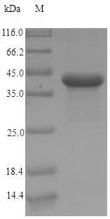 Human CEACAM7 Protein (Recombinant 6His-SUMO, N-terminus)