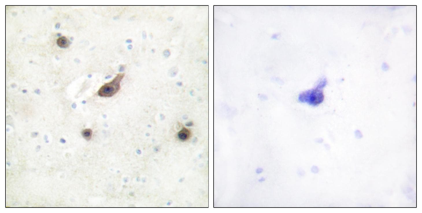 Polyclonal Rabbit anti-Human BRAF / B-Raf Antibody (IHC, IF, WB)