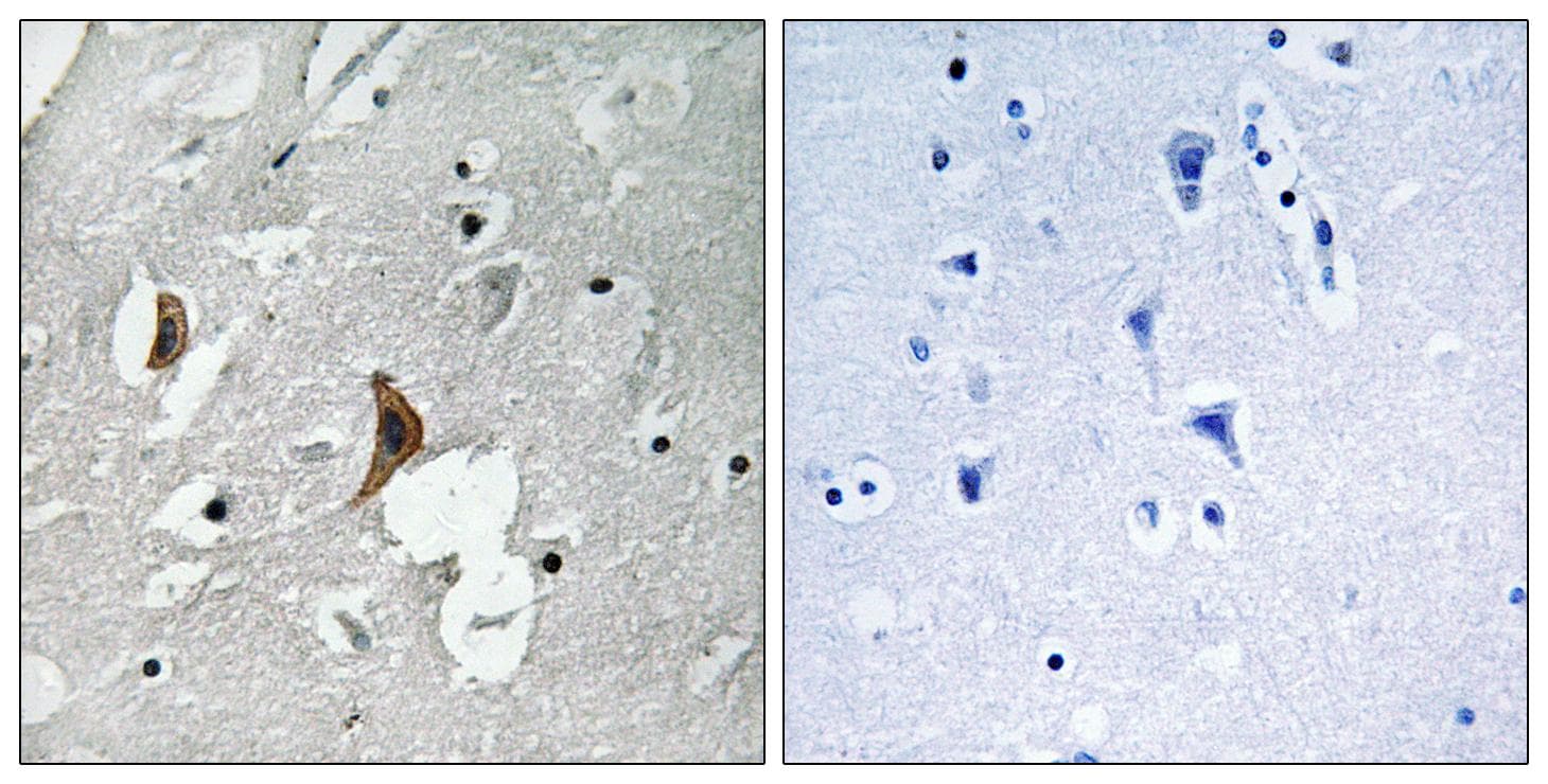 Polyclonal Rabbit anti-Human GRIN2B / NMDAR2B / NR2B Antibody (phospho-Tyr1336, IHC, WB)