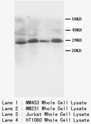 SSX2 Antibody (C-Terminus)