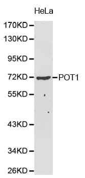 POT1 Antibody