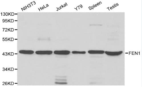 Polyclonal Rabbit anti-Human FEN1 Antibody (IHC, WB)