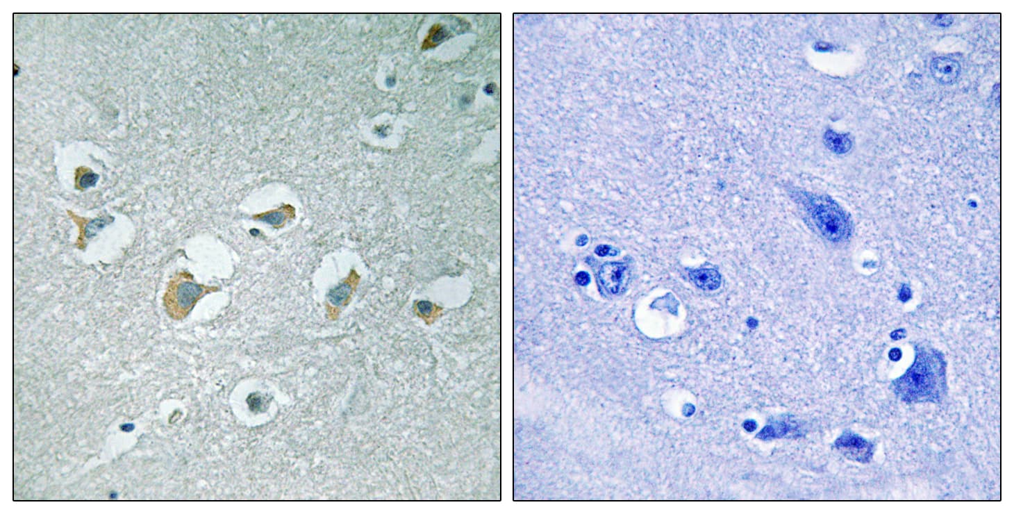 MLK1+2 Antibody (phospho-Thr312/Thr266)