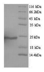 Human AQP4 / Aquaporin 4 Protein (Recombinant 6His, N-terminus)