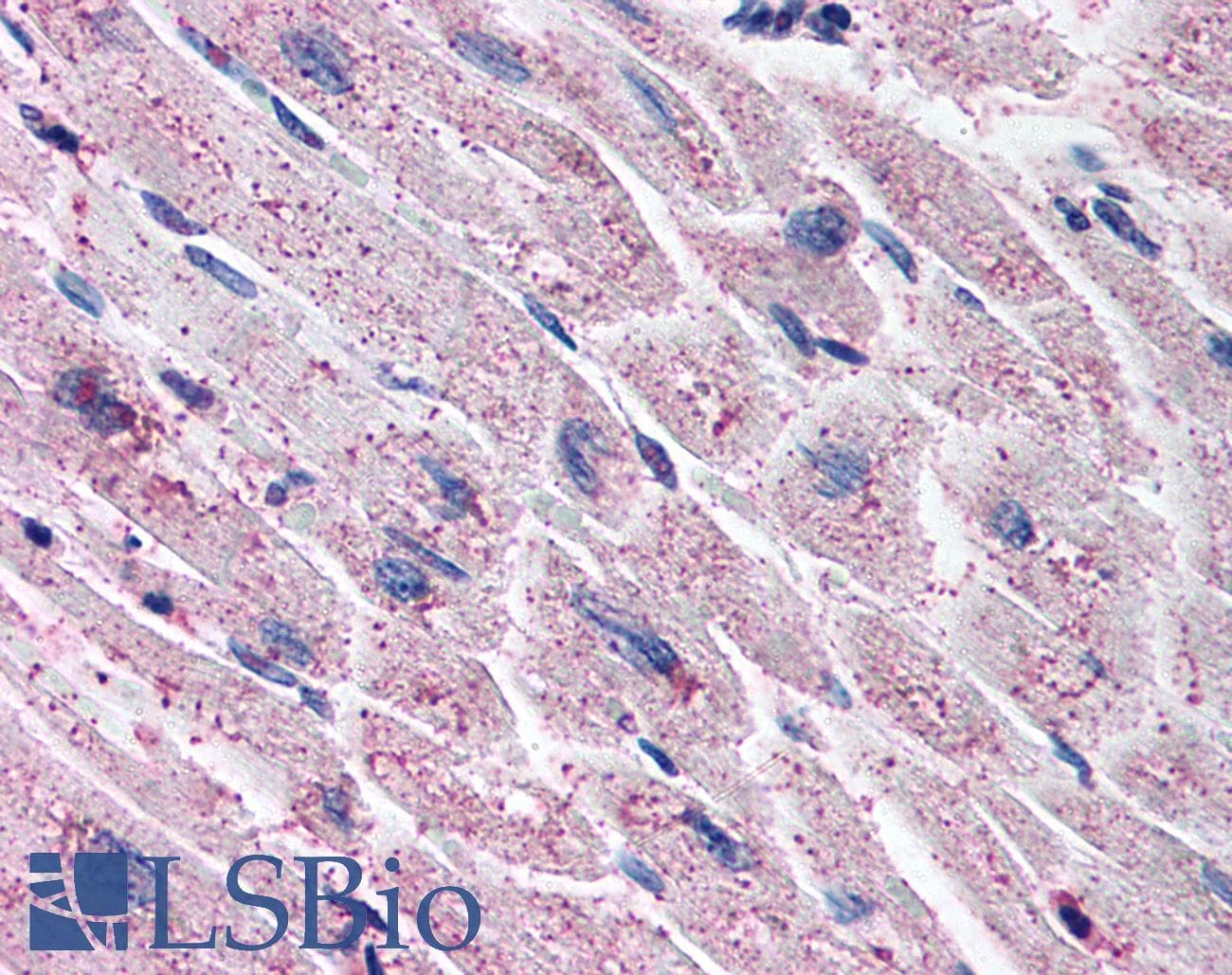 IHC-plus™ Polyclonal Rabbit anti-Human EDNRA / Endothelin A Receptor Antibody (C-Terminus, IHC)
