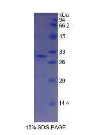 Human CFI / Complement Factor I Protein (Recombinant His)