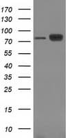 CTNNB1 / Beta Catenin Antibody (clone OTI9F6)