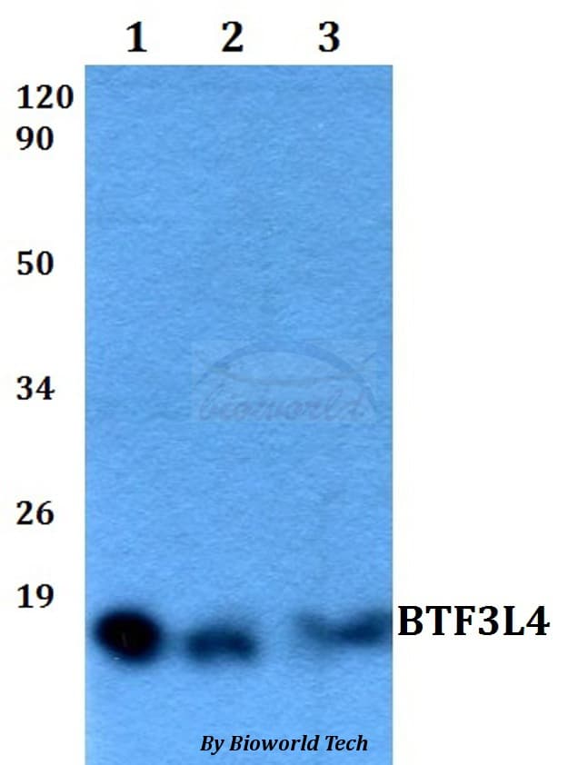 Polyclonal Rabbit anti-Human BTF3L4 Antibody (WB)