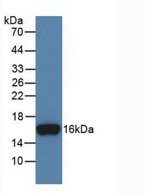 INHBB / Inhibin Beta B Antibody