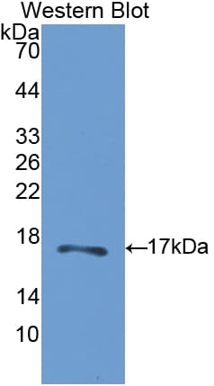 CA-VB / CA5B Antibody (aa174-311)