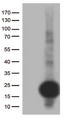 SCP2D1 / C20orf79 Antibody (clone OTI6A6)
