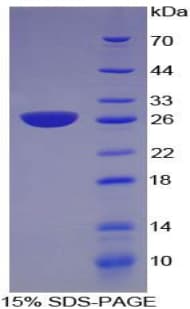 Mouse NNMT Protein (Recombinant His, N-Terminal)