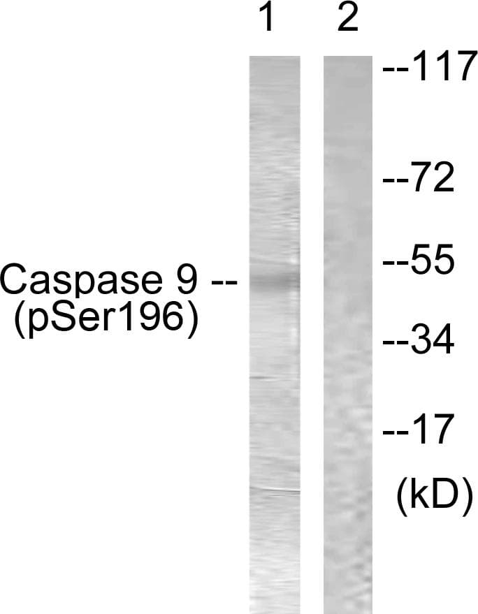 Polyclonal Rabbit anti-Human CASP9 / Caspase 9 Antibody (phospho-Ser196, WB)