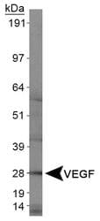 VEGFA / VEGF Antibody (clone VG1)