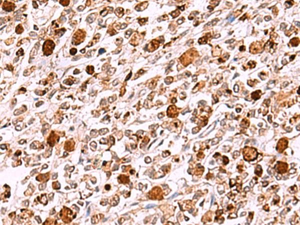 INO80 Antibody