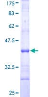 Human CD121b / IL1R2 Protein (Recombinant GST, N-terminus)