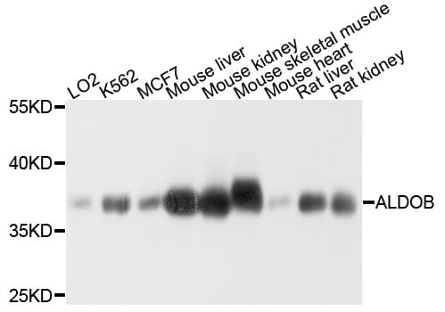 Polyclonal Rabbit anti-Human ALDOB Antibody (WB)