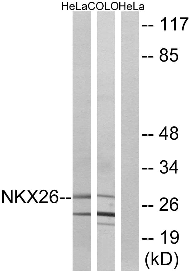 NKX2-6 Antibody (aa91-140)