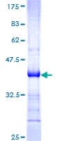 Human PDGF-CC Protein (Recombinant GST, N-terminus)