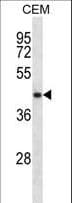 Polyclonal Rabbit anti-Human NDRG2 Antibody (aa42-70, WB)