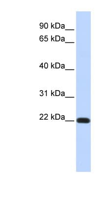 FXYD5 / Dysadherin Antibody (aa108-157)