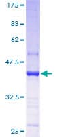 Human Trimethylguanosine Synthase 1 Protein (Recombinant GST)