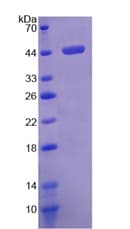 Human FMOD / Fibromodulin Protein (Recombinant His-T7)