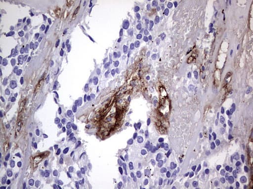 VWF / Von Willebrand Factor Antibody (aa764-1263, clone OTI7G3, Carrier-free)
