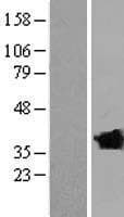CLVS2 Protein (Over-Expression Lysate Myc-DDK (Flag))