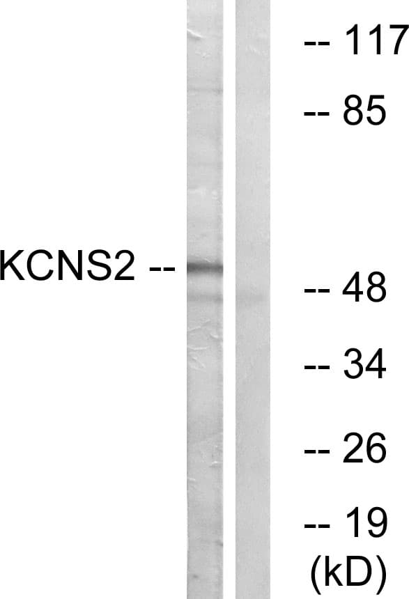 KCNS2 Antibody (aa197-246)