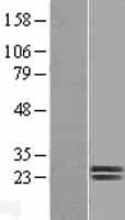 Human Dermatopontin / DPT Protein (Over-Expression Lysate Myc-DDK (Flag))