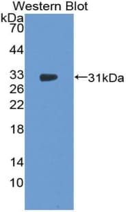 F13A1 / Factor XIIIa Antibody (aa107-345, APC)