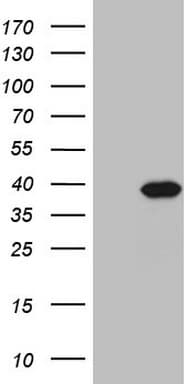 PPA2 Antibody (clone OTI7C1)