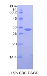 Human PDIA3 / ERp57 Protein (Recombinant His)