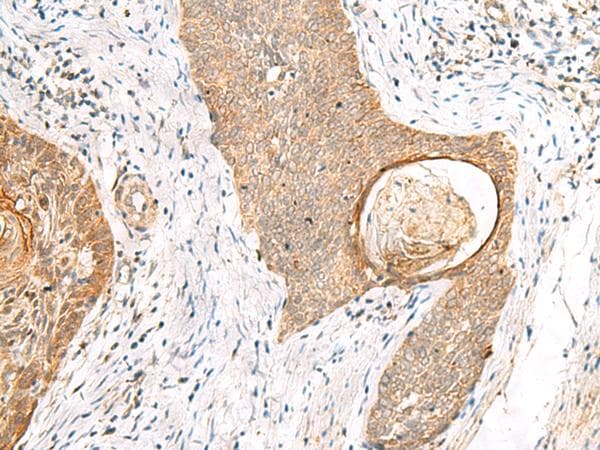 TOR1A / Torsin A Antibody