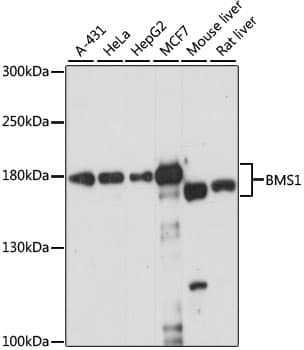 Polyclonal Rabbit anti-Human BMS1 Antibody (WB)