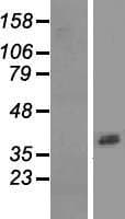ASPRV1 / SASPase Protein (Over-Expression Lysate Myc-DDK (Flag))