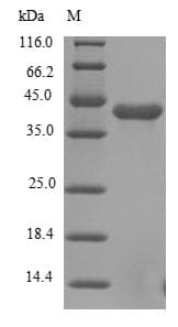Human FGFR1 / FGF Receptor 1 Protein (Recombinant 6His, N-terminus)