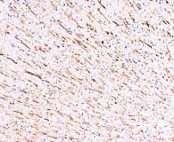 MAP1 Antibody (clone MP-1)