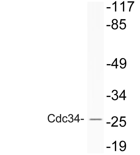 CDC34 Antibody (Asp163)