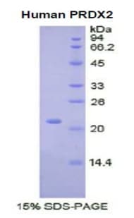 Human PRDX2 / Peroxiredoxin 2 Protein (Recombinant His)