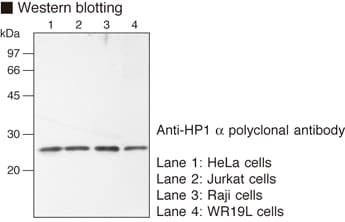 Polyclonal Rabbit anti-Human CBX5 / HP1 Alpha Antibody (IHC, WB)
