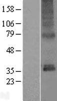 TMEM115 Protein (Over-Expression Lysate Myc-DDK (Flag))