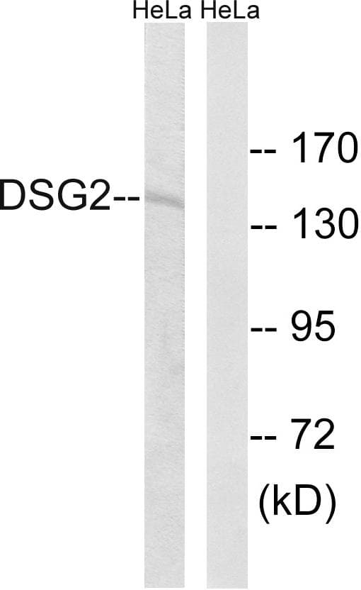 DSG2 / Desmoglein 2 Antibody