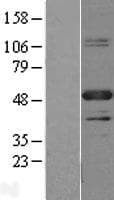 PBX1 Protein (Over-Expression Lysate Myc-DDK (Flag))