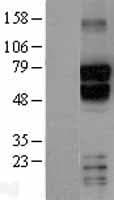 Human TBR1 Protein (Over-Expression Lysate Myc-DDK (Flag))