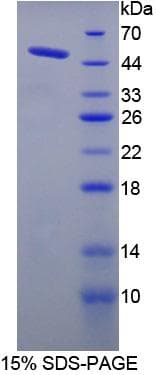 Human Mannose Phosphate Isomerase Protein (Recombinant His-T7)