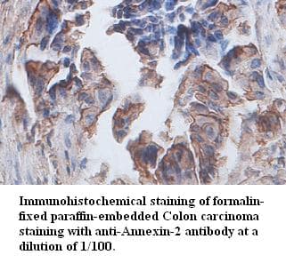 ANXA2 / Annexin A2 Antibody