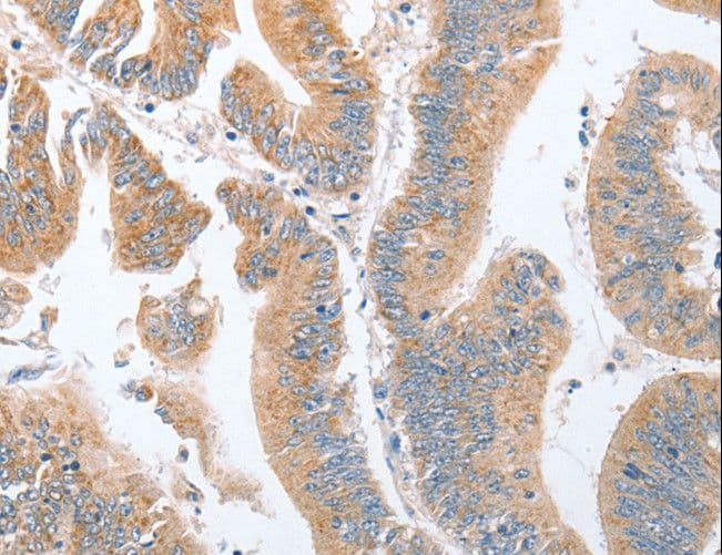 PARD6A / PAR6 Antibody